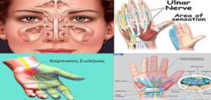 Αυτοθεραπεία  από ιγμορίτιδα, τενοντίτιδα, πόνους στα χέρια και στα δάκτυλα της Στέλλας Ρούση 1