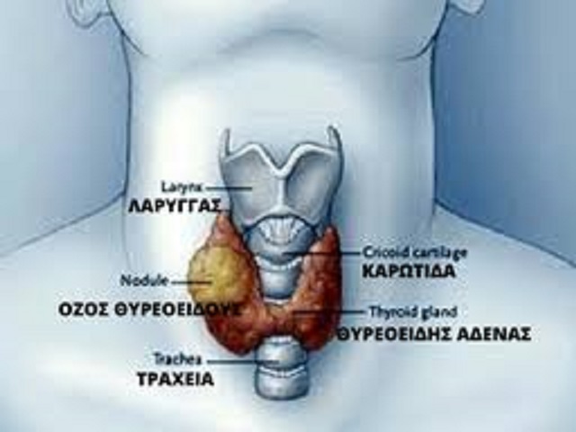 Αυτοθεραπεία από όζους στο θυρεοειδή αδένα της Αθηνάς Δαρζέντα. 25