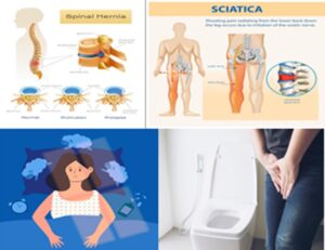 Αυτοθεραπεία  από αυπνοία, συχνοουρία, αυχαινικό, κρύα πόδια, λίπωμα, πρόβλημα στη μέση. 1 Αυτοθεραπεία  από αυπνοία, συχνοουρία, αυχαινικό, κρύα πόδια, λίπωμα, πρόβλημα στη μέση. 1