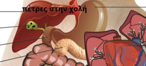 Αυτοθεραπεία από πέτρες και λάσπη στη χολή ξεμπλοκάροντας τον μεσημβρινό της χολής. 1 Αυτοθεραπεία από πέτρες και λάσπη στη χολή ξεμπλοκάροντας τον μεσημβρινό της χολής. 1