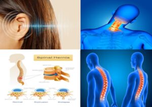 Πως αυτοθεραπεύτηκα από εμβοές στα αυτιά, κήλες στον αυχένα, σκολίωση, κήλες στη μέση. 1 Πως αυτοθεραπεύτηκα από εμβοές στα αυτιά, κήλες στον αυχένα, σκολίωση, κήλες στη μέση. 1