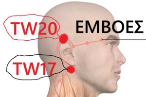 Self-medication from tinnitus, hernias in the neck, scoliosis, hernias in the middle, stomach problems and gastroesophageal reflux. 3 Αυτοθεραπεία από εμβοές στα αυτιά, κήλες στον αυχένα, σκολίωση, κήλες στη μέση, προβλήματα στο στομάχι και γαστροισοφαγική παλινδρόμηση. 3